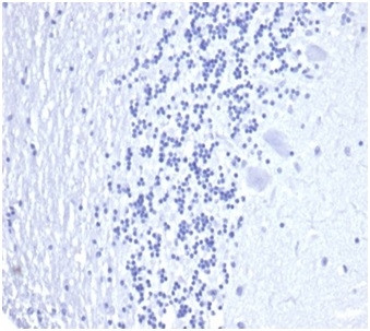 Prostate Specific Antigen (PSA) Antibody in Immunohistochemistry (Paraffin) (IHC (P))
