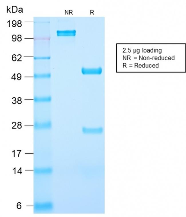 Prostate Specific Antigen (PSA) Antibody in SDS-PAGE (SDS-PAGE)