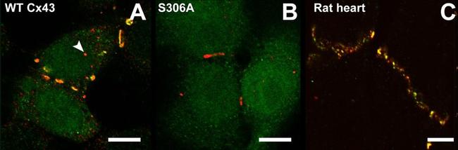 Connexin 43 Antibody in Immunohistochemistry (IHC)