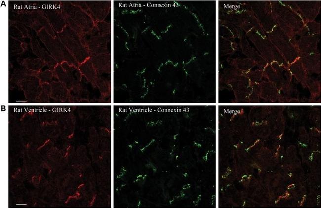 Connexin 43 Antibody in Immunohistochemistry (Frozen) (IHC (F))