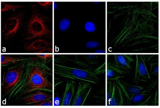 Mouse IgG (H+L) Cross-Adsorbed Secondary Antibody in Immunocytochemistry (ICC/IF)