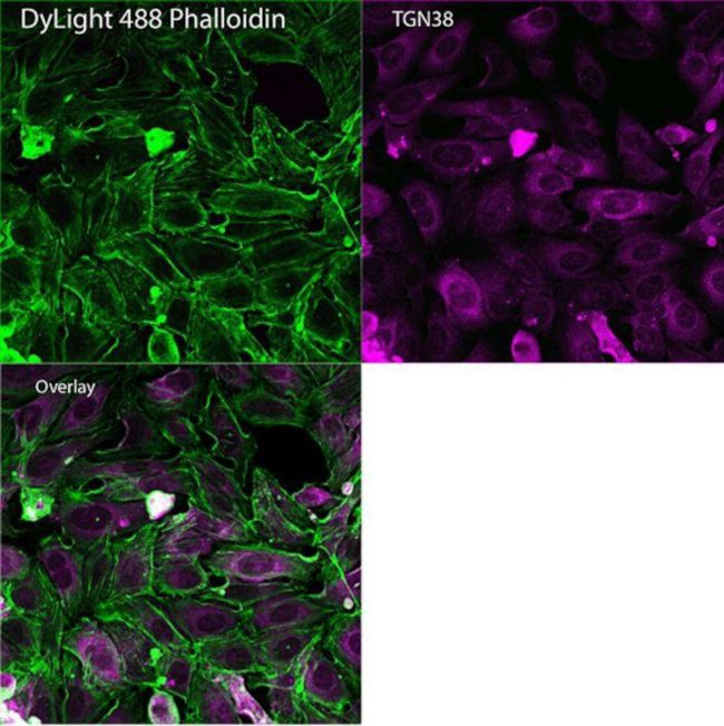 Mouse IgG (H+L) Secondary Antibody in Immunocytochemistry (ICC/IF)