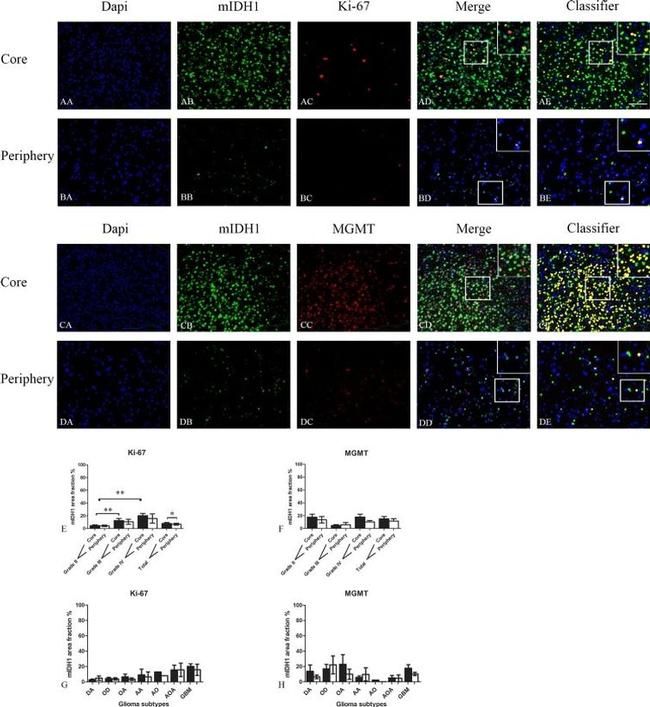 MGMT Antibody in Immunohistochemistry (Paraffin) (IHC (P))