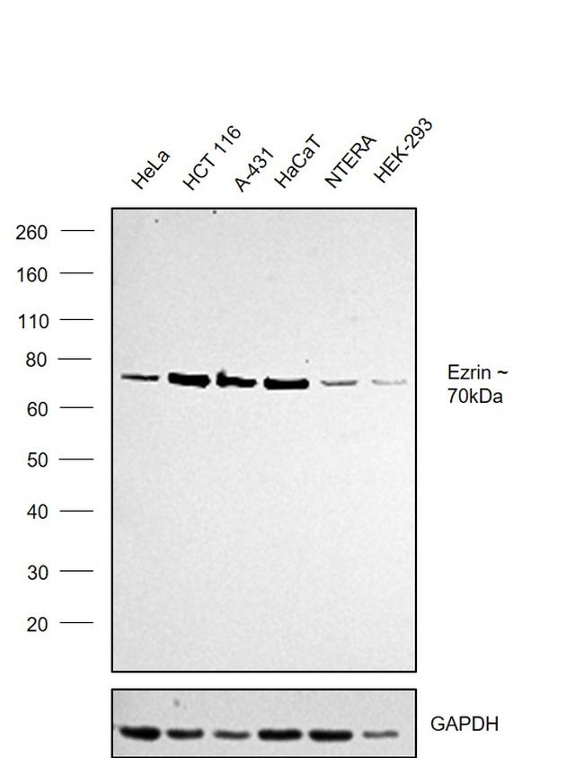 Ezrin Antibody in Western Blot (WB)