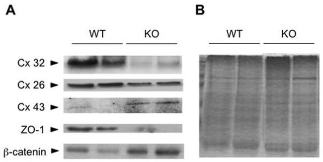 Connexin 32 Antibody in Western Blot (WB)