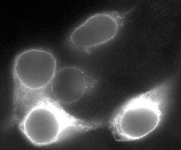 LRP5 Antibody in Immunocytochemistry (ICC/IF)