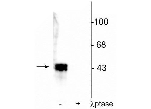 Phospho-ERK1/ERK2 (Thr202, Tyr204) Antibody in Western Blot (WB)