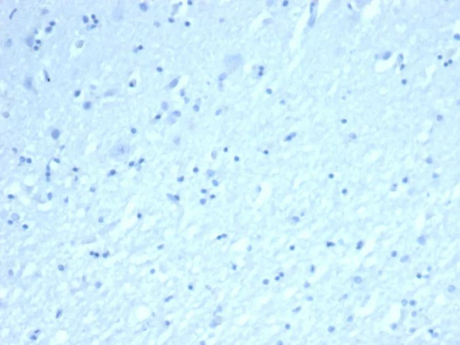 Inhibin, alpha (INHA) (Gonadal Cell Marker) Antibody in Immunohistochemistry (Paraffin) (IHC (P))