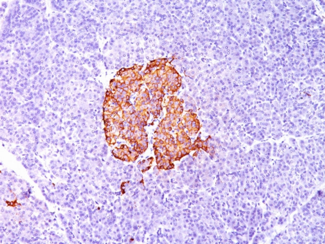 Insulin (beta-Cell and Insulinoma Marker) Antibody in Immunohistochemistry (Paraffin) (IHC (P))