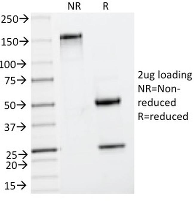 Insulin/IRDN Antibody in SDS-PAGE (SDS-PAGE)