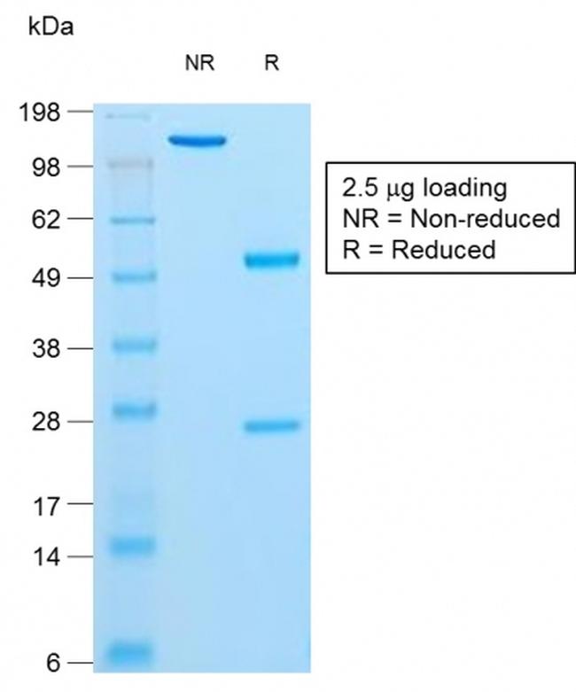 Insulin/IRDN Antibody in SDS-PAGE (SDS-PAGE)