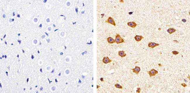 Claudin 11 Antibody in Immunohistochemistry (Paraffin) (IHC (P))