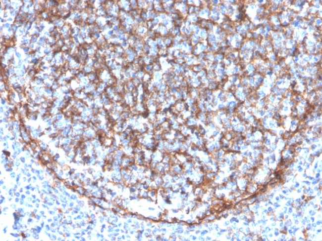 CD11b/MAC-1 Antibody in Immunohistochemistry (Paraffin) (IHC (P))