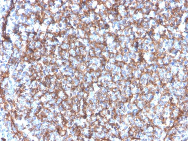 CD11b/MAC-1 Antibody in Immunohistochemistry (Paraffin) (IHC (P))