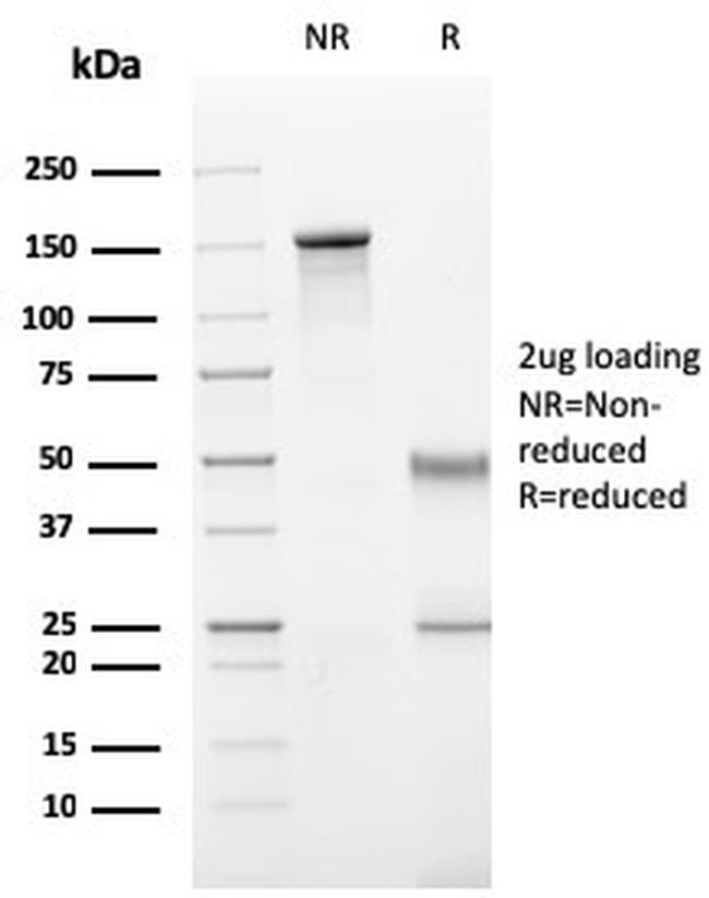 CD11b/MAC-1 Antibody in SDS-PAGE (SDS-PAGE)