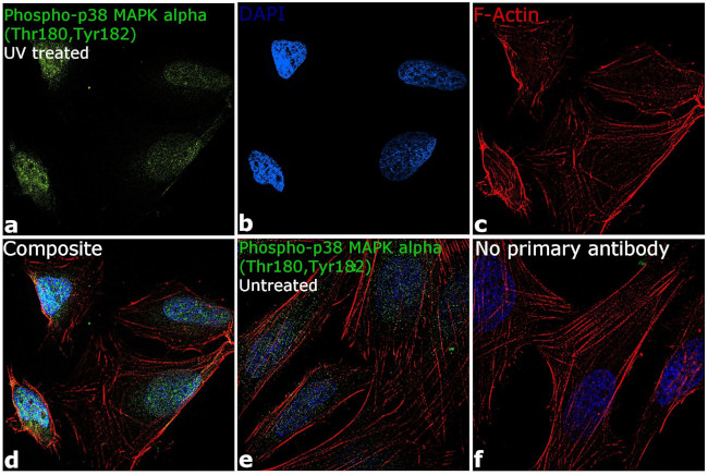 PTMScan® Phospho-MAPK/CDK Substrate Motif (PXS*P and S*PXK/R) Kit