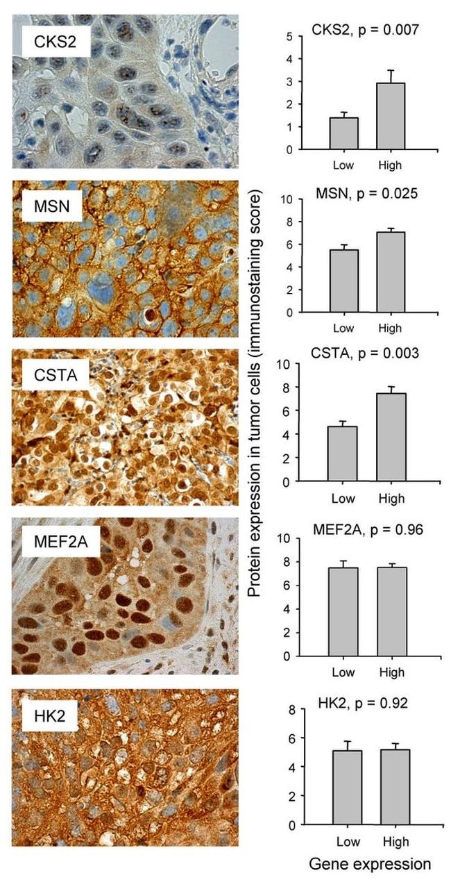 CKS2 Antibody in Immunohistochemistry (Paraffin) (IHC (P))