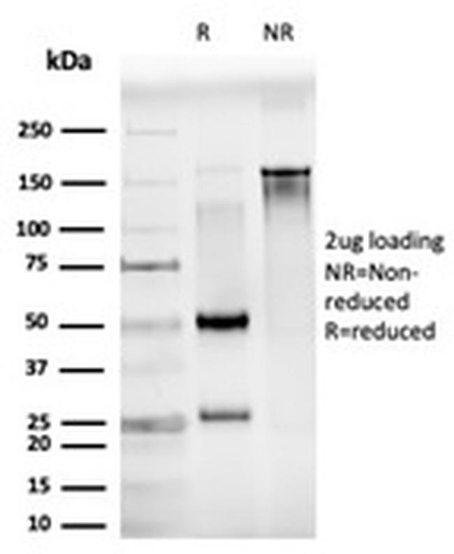 JunB/Transcription Factor JunB Antibody in SDS-PAGE (SDS-PAGE)