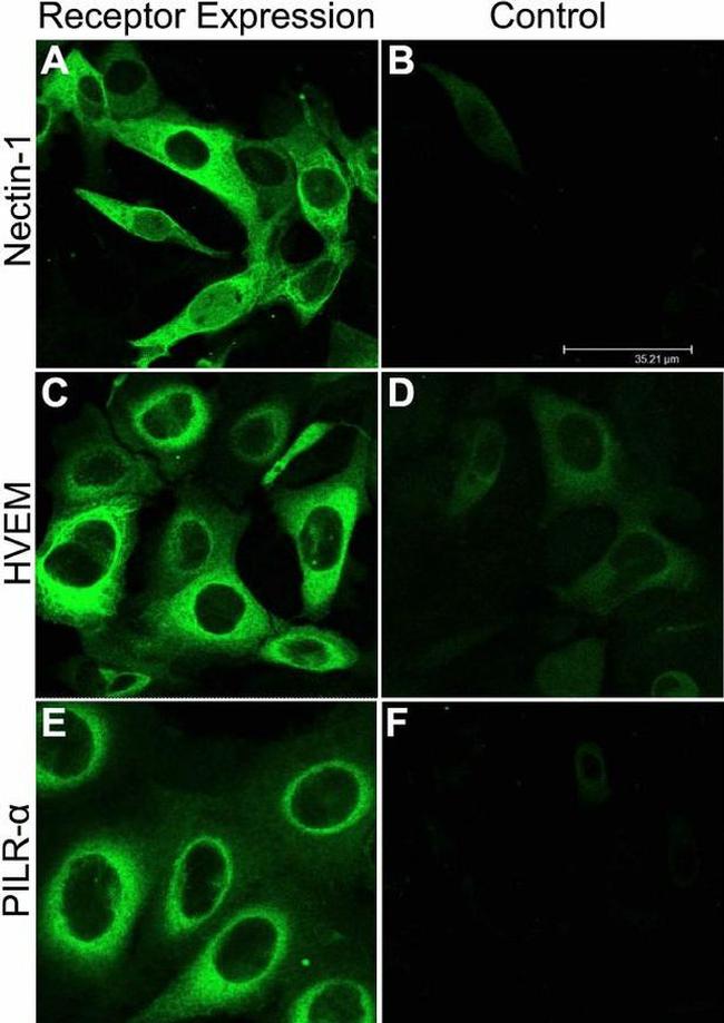 Nectin 1 Antibody in Immunocytochemistry (ICC/IF)