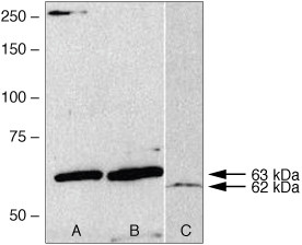 AMPK gamma-2 Antibody in Western Blot (WB)