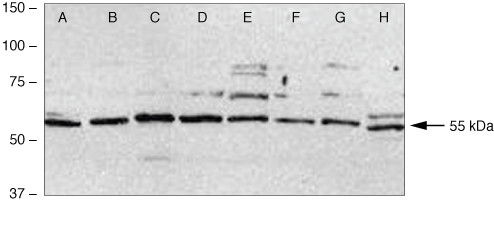 c-Fos Antibody in Western Blot (WB)