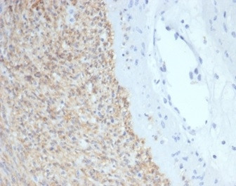 CD117/c-Kit (Marker for Gastrointestinal Stromal Tumors) Antibody in Immunohistochemistry (Paraffin) (IHC (P))