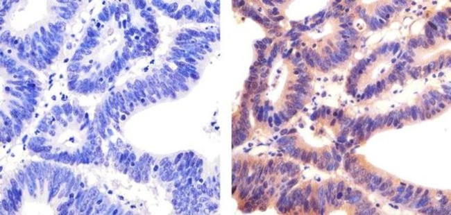 SOCS1 Antibody in Immunohistochemistry (Paraffin) (IHC (P))