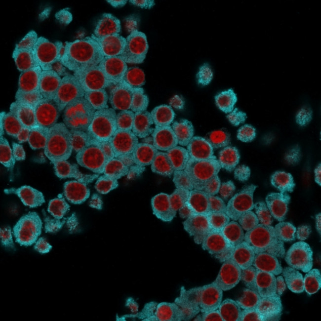 Cytokeratin 6 (Basal Cell Marker) Antibody in Immunocytochemistry (ICC/IF)