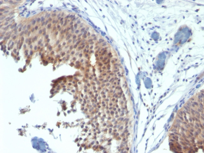 Cytokeratin 6 (Basal Cell Marker) Antibody in Immunohistochemistry (Paraffin) (IHC (P))