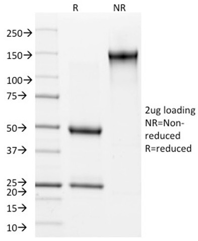 Cytokeratin 15 (Esophageal Squamous Cell Carcinoma Marker) Antibody in SDS-PAGE (SDS-PAGE)