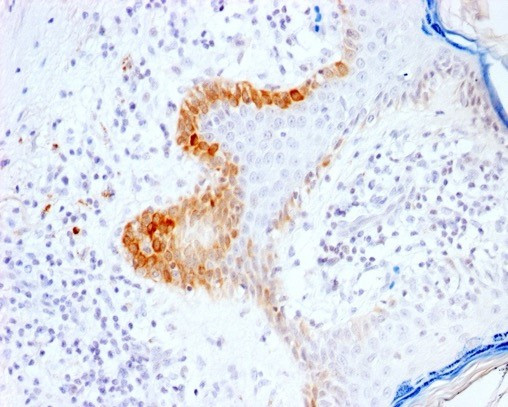 Cytokeratin 15 (Esophageal Squamous Cell Carcinoma Marker) Antibody in Immunohistochemistry (Paraffin) (IHC (P))