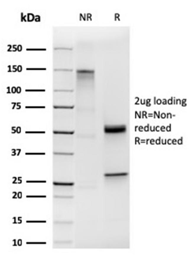 Cytokeratin 19 (KRT19) Antibody in SDS-PAGE (SDS-PAGE)