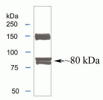 MTA1 Antibody in Western Blot (WB)