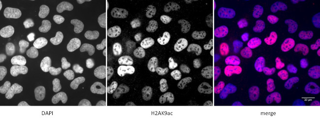 Histone H2AK9ac Antibody in Immunocytochemistry (ICC/IF)