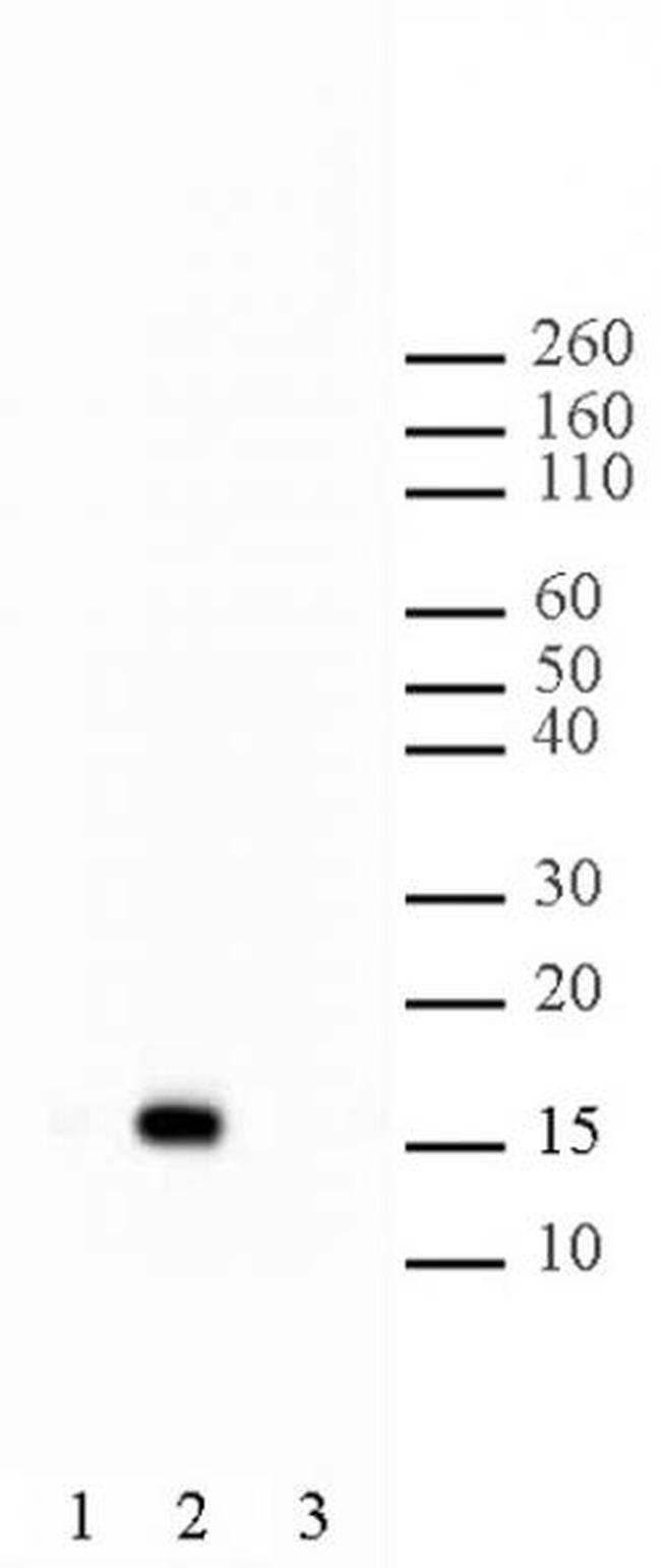 Histone H2BK5ac Antibody in Western Blot (WB)