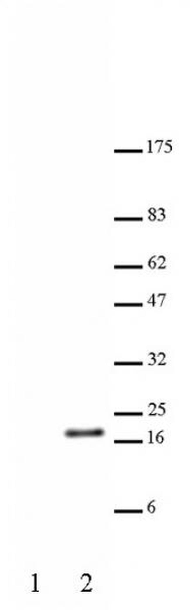 Histone H3K23ac Antibody in Western Blot (WB)