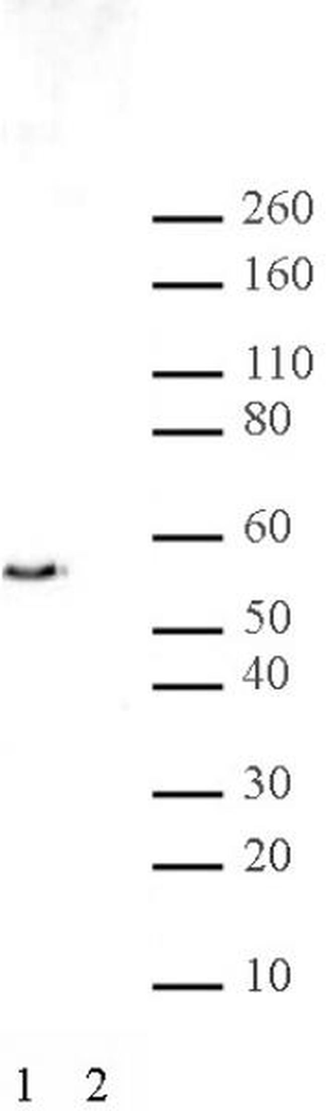 JMJD2D Antibody in Western Blot (WB)