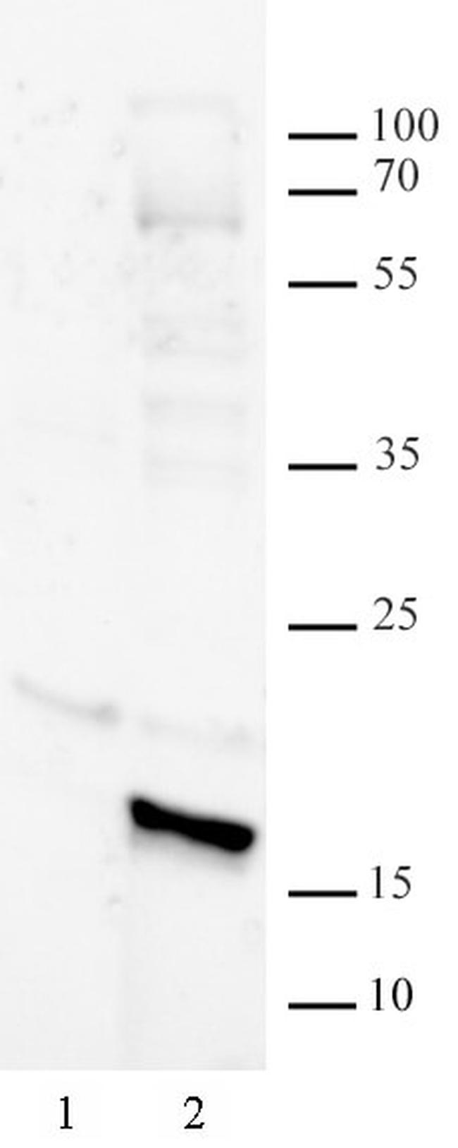 Histone H3K14bz Antibody in Western Blot (WB)