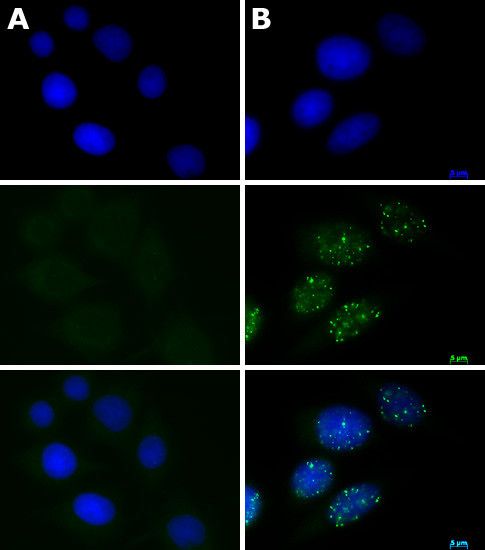 Phospho-ATM (Ser1981) Antibody in Immunocytochemistry (ICC/IF)