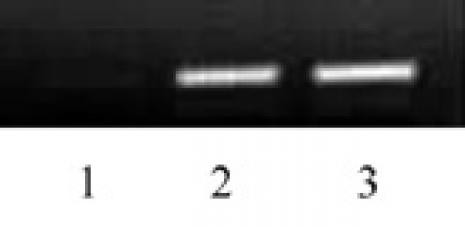 Histone H3K79ac Antibody in ChIP Assay (ChIP)