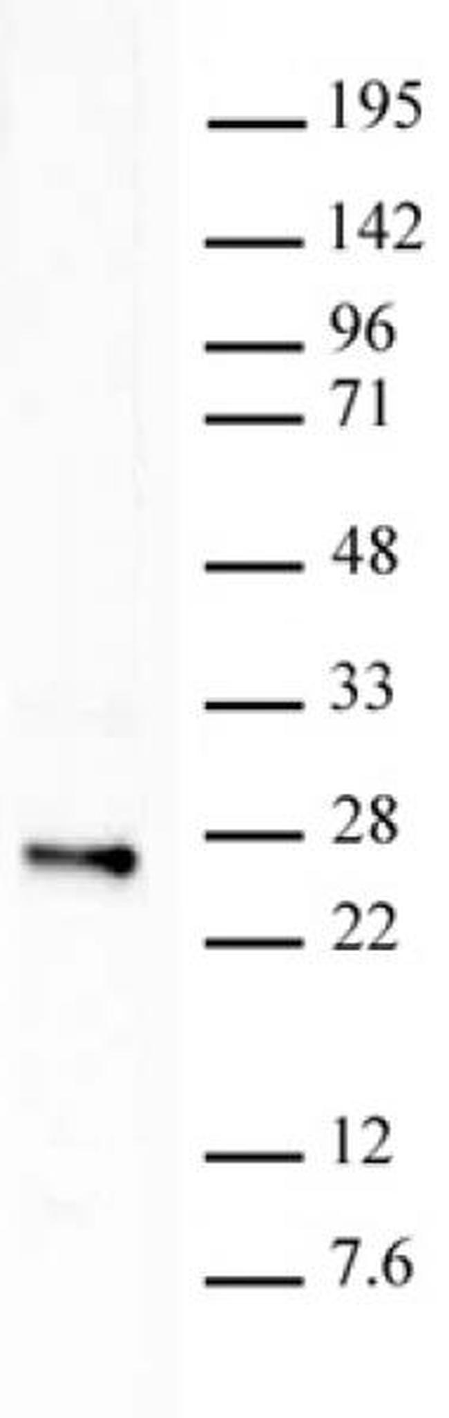 Histone H2BK120ub1 Antibody in Western Blot (WB)