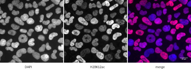 Histone H2BK12ac Antibody in Immunocytochemistry (ICC/IF)