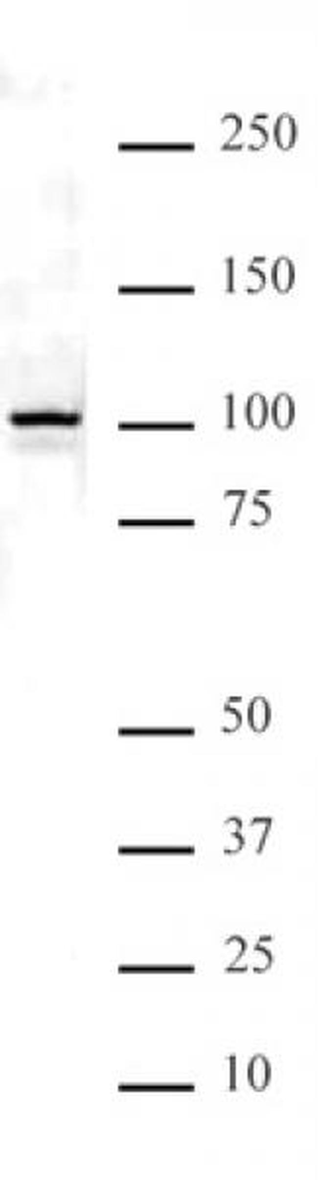 NFkB p100 Antibody in Western Blot (WB)