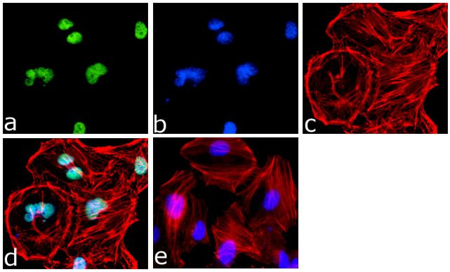 KLF6 Antibody in Immunocytochemistry (ICC/IF)