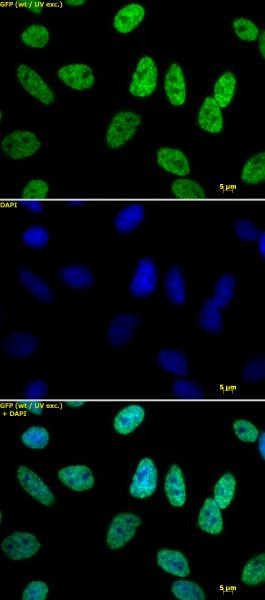 Histone H3K18ac Antibody in Immunocytochemistry (ICC/IF)