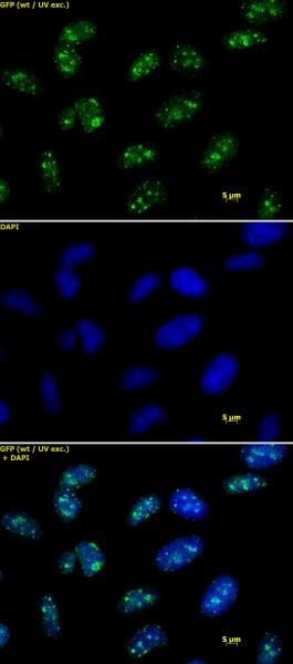 Histone H3K9me3 Antibody in Immunocytochemistry (ICC/IF)