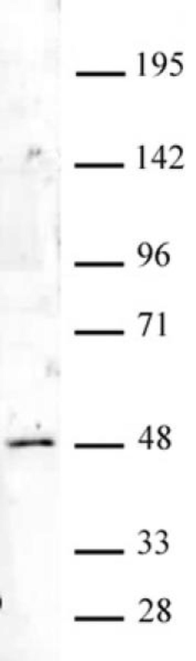 HOXA9 Antibody in Western Blot (WB)