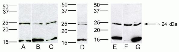 HOXB7 Antibody in Western Blot (WB)