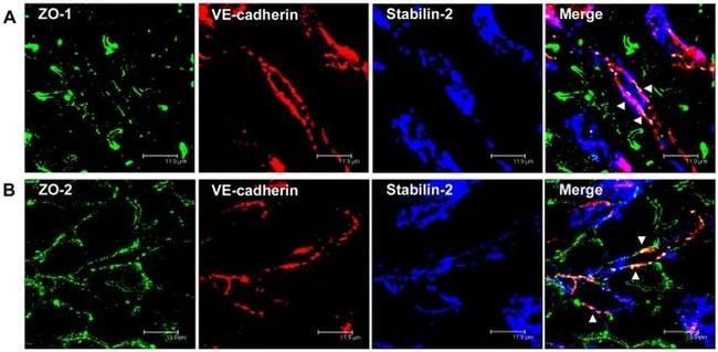 ZO-2 Antibody in Immunohistochemistry (IHC)