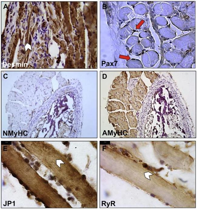 JPH1 Antibody in Immunohistochemistry (IHC)